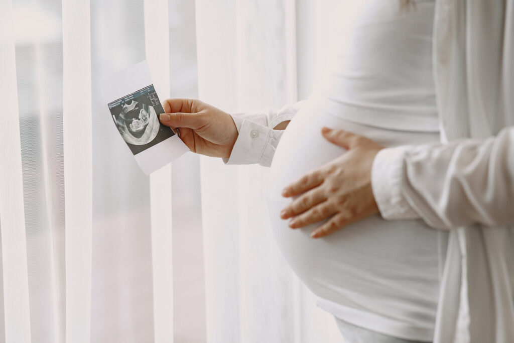 Договір з клінікою про сурогатне материнство. На що звернути увагу? - pregnant woman standing by window looking photo